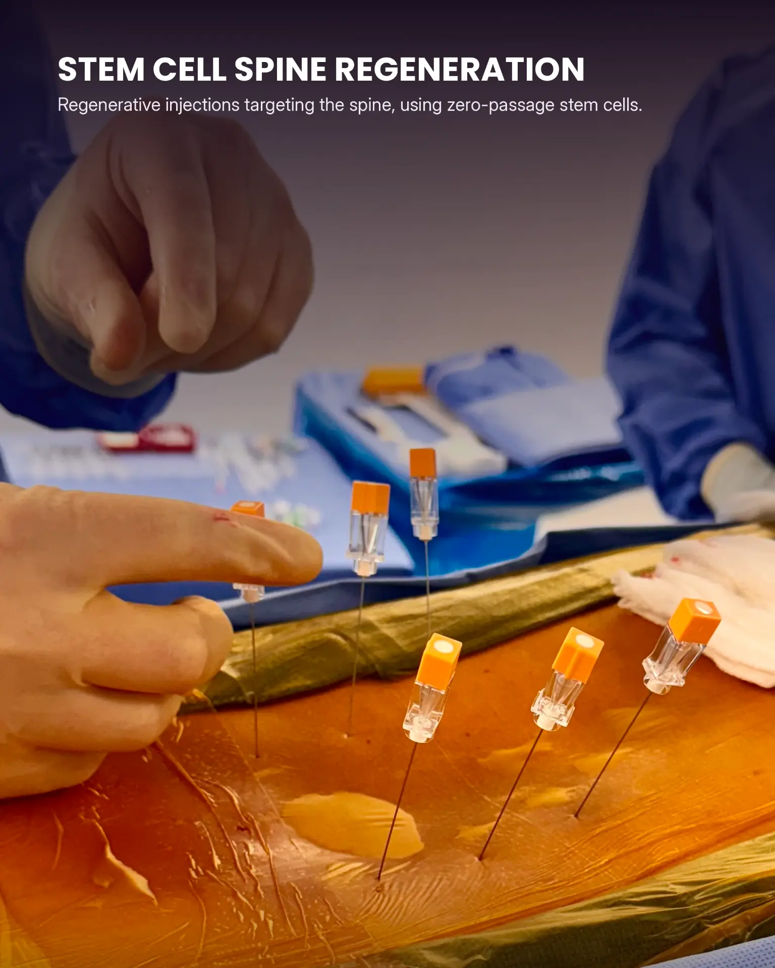 Stem cell spine regeneration