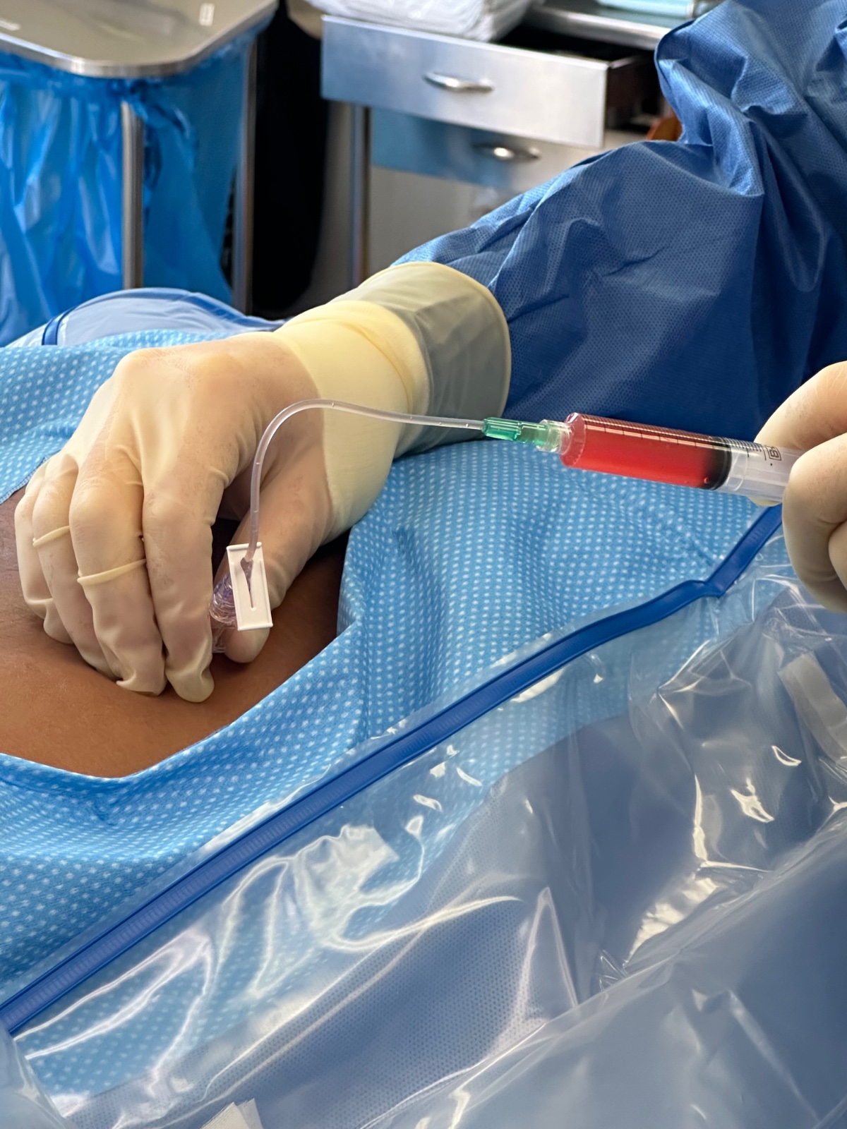 Doctor-guided stem cell injection